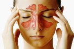sinusi-i-sinusitis